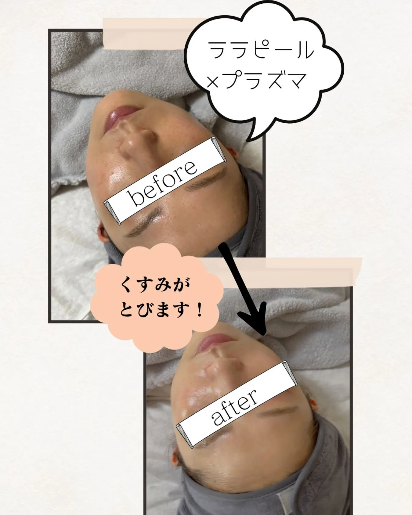 #ララピール × #プラズマ