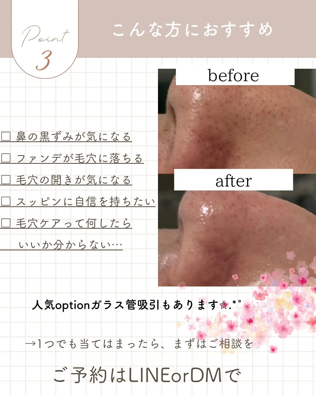 【毛穴、なかったことに。