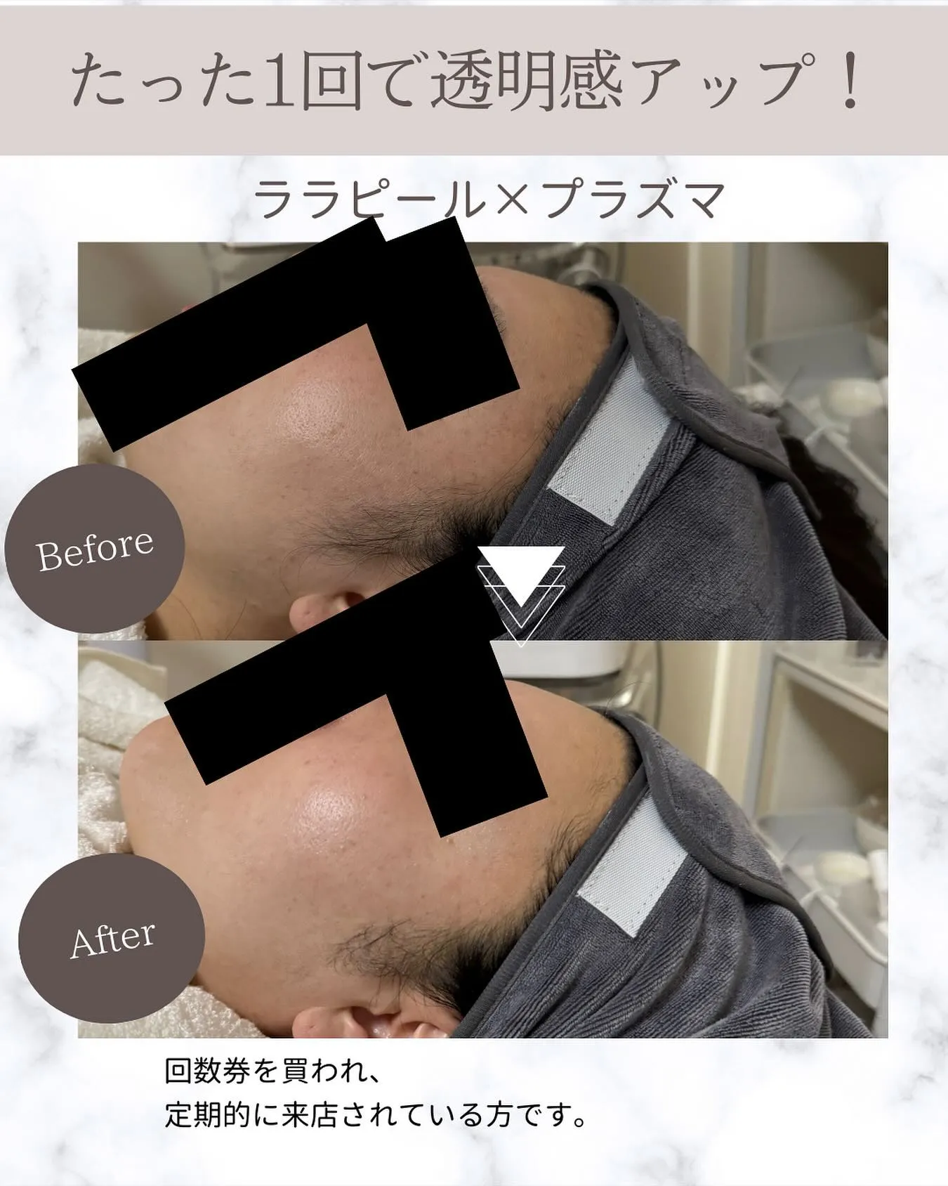＼たった1回でもこの透明感…！／