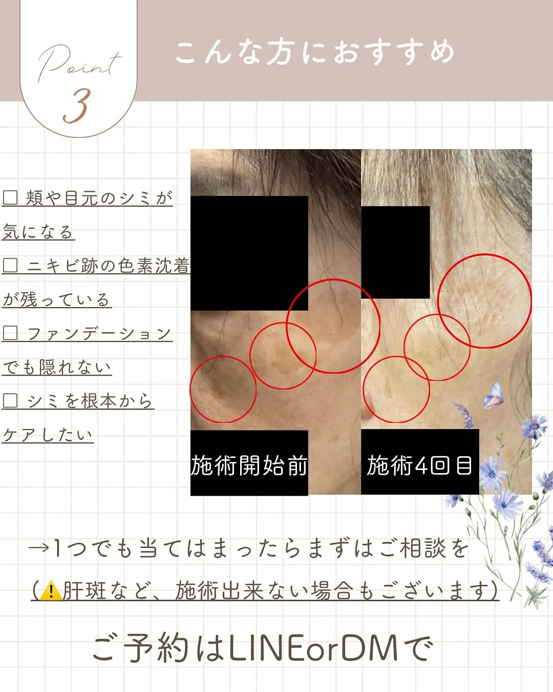 シミが増えてきた…？？