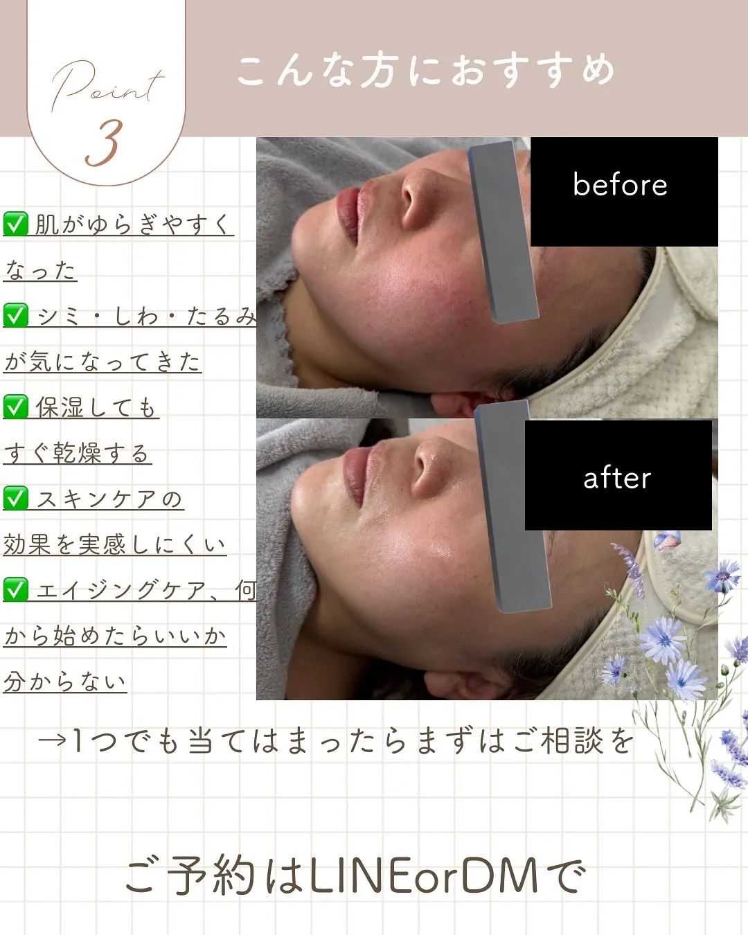 ＼ 肌のゆらぎ、根本から立て直したい方へ ／