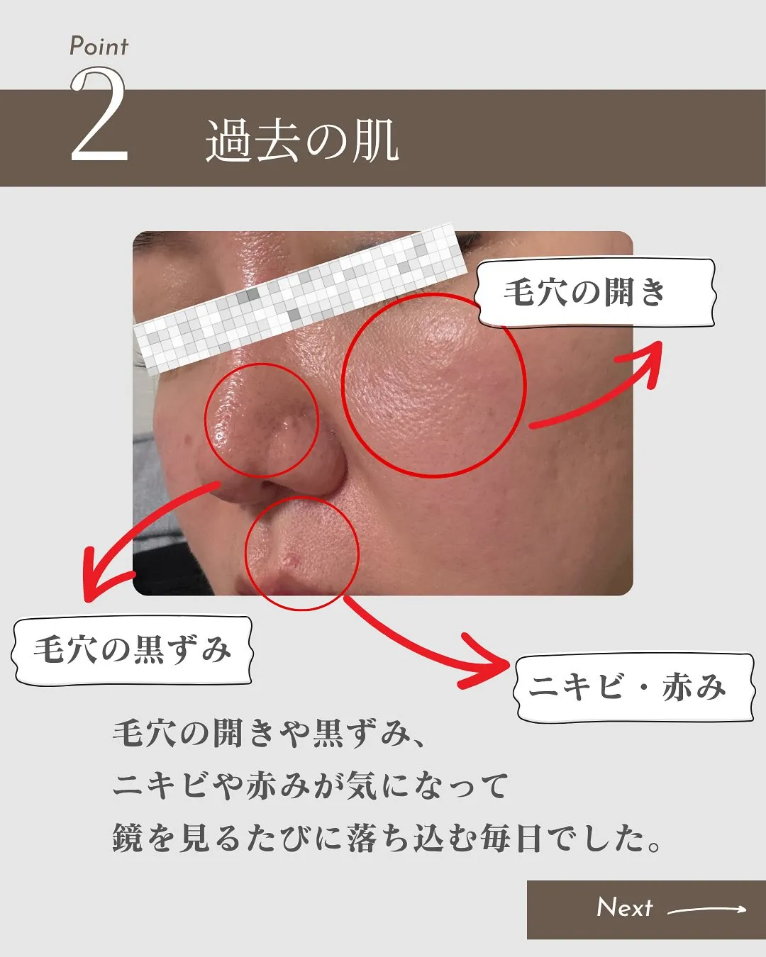 山口県宇部市のエステサロン