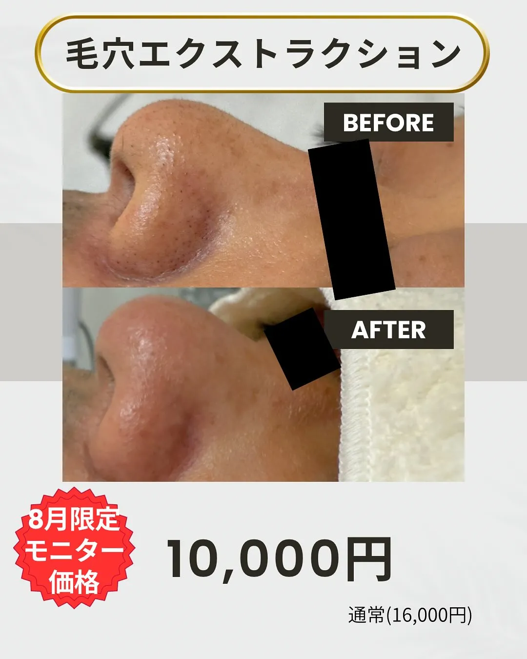【こんなに変わるなんて…毛穴人生が変わりました】