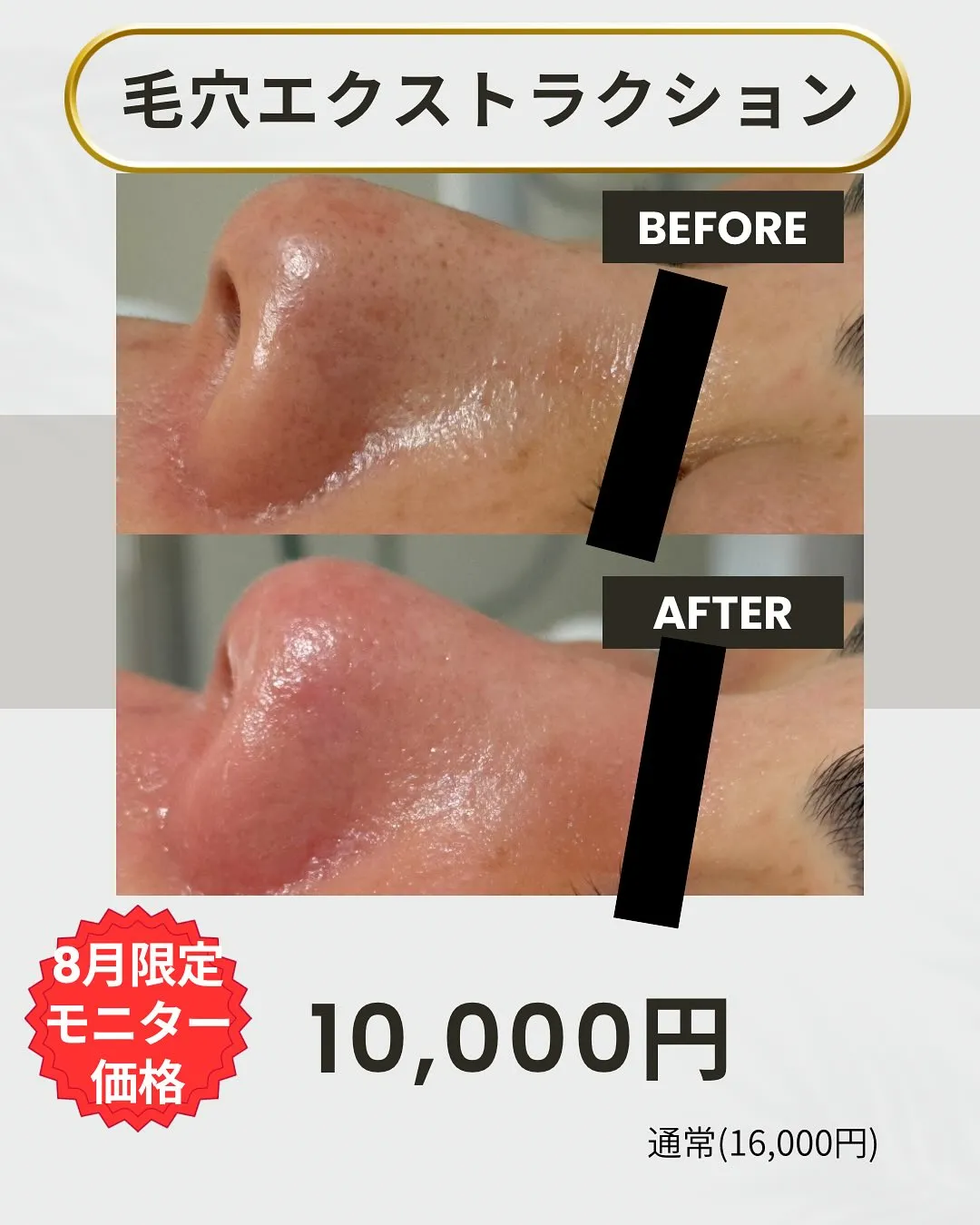 「毛穴の黒ずみ、何しても消えない…」そう思っていた方ほど、1...