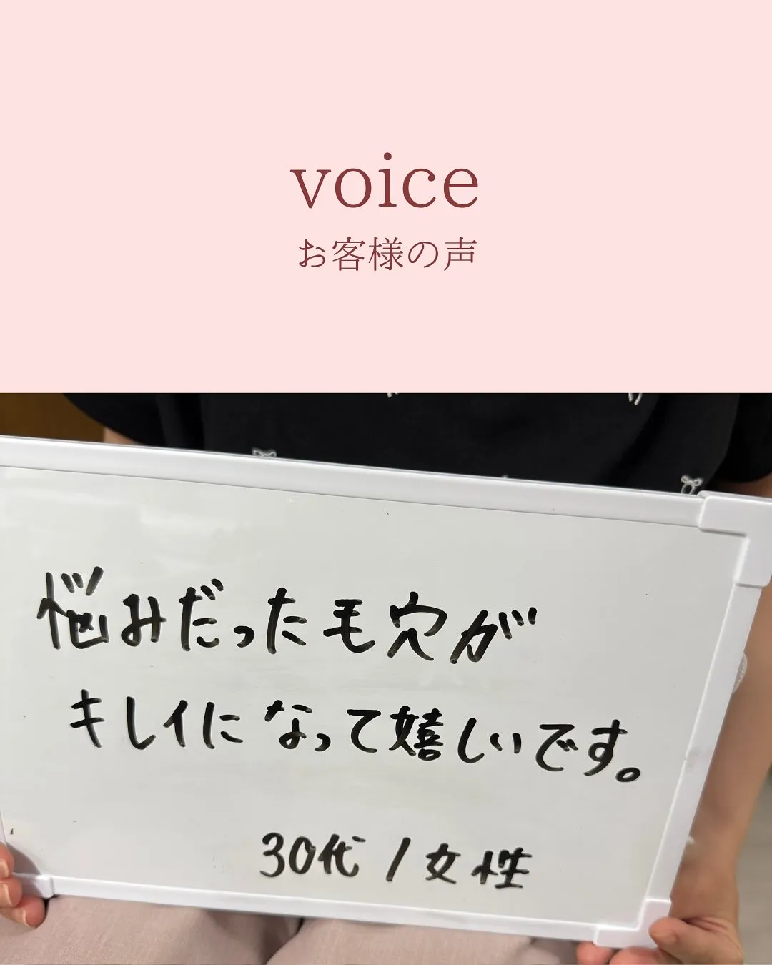 ビフォー写真に映る黒ずみや詰まり…実はこれ、たった1回の施術...