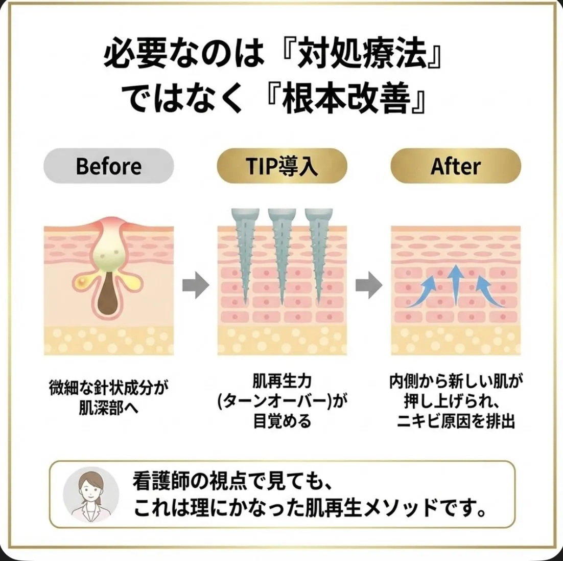 「もう、このニキビと一生付き合っていくしかない…」