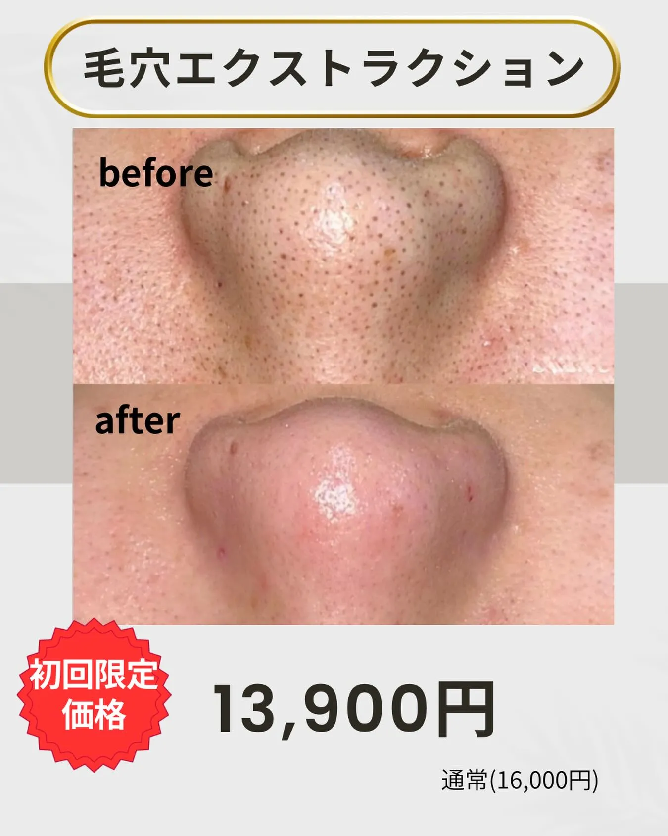 「もう、加工アプリはいりません。