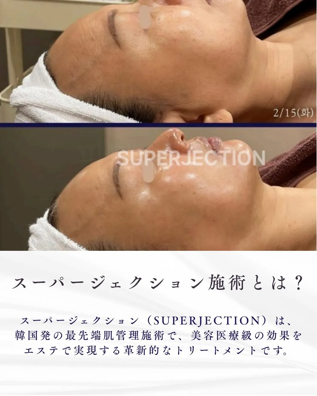 😱 知らないと5年後に後悔する肌事実