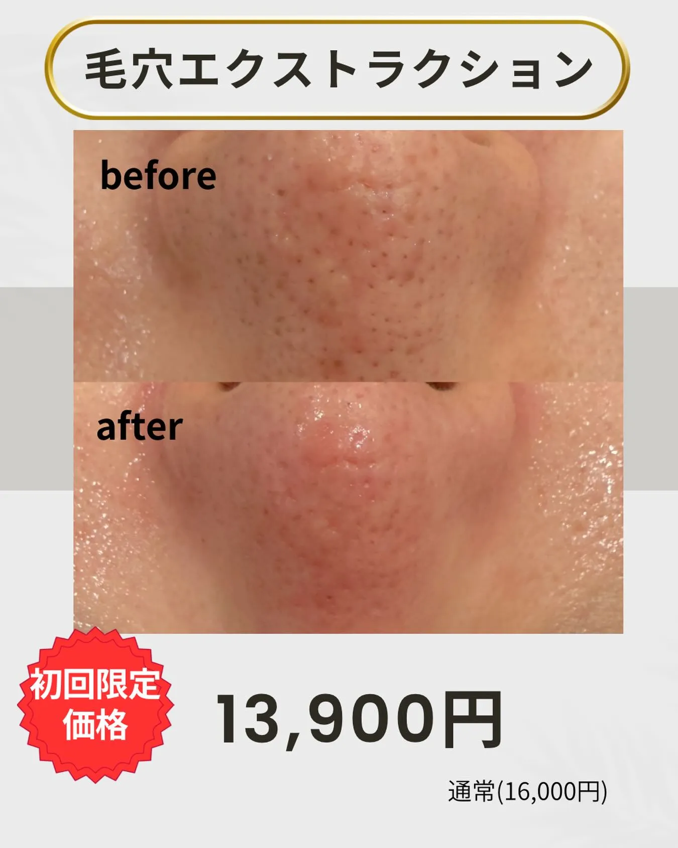 「毛穴、隠せないって思ってた。