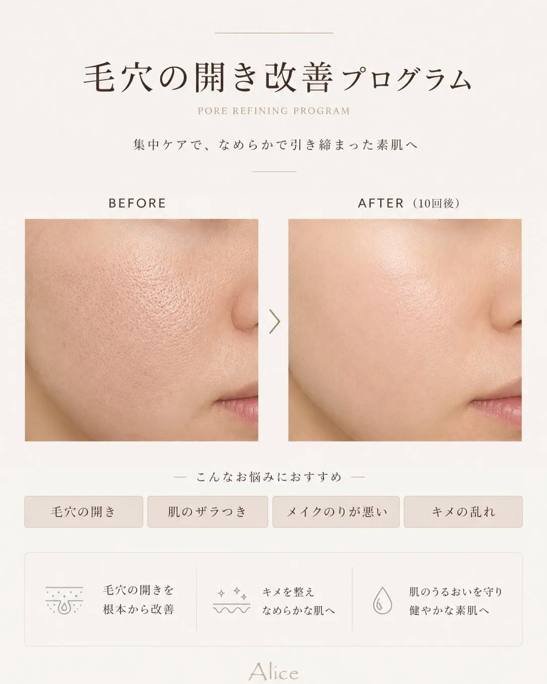 【毛穴の開き、本気で変えたい方へ】