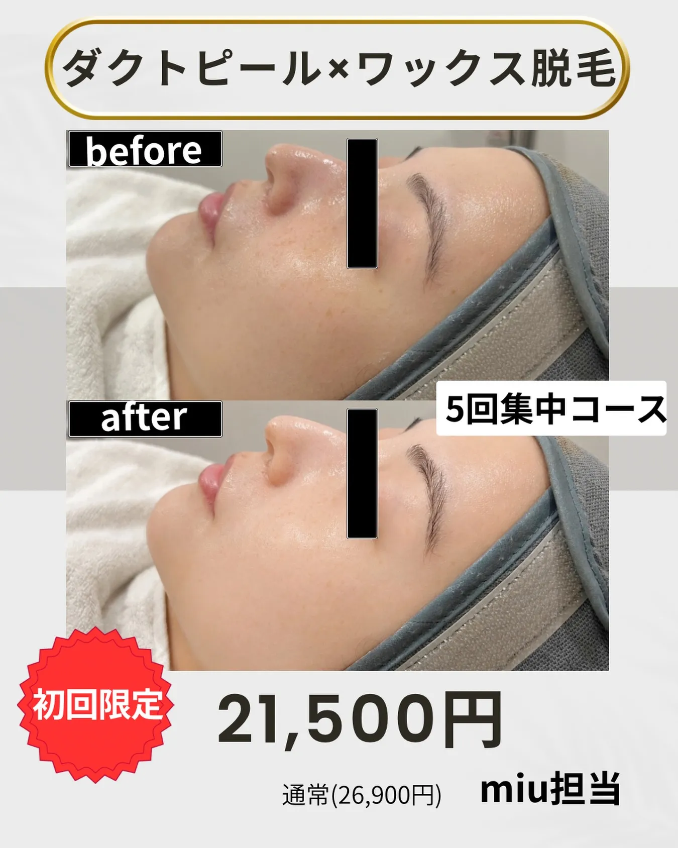 ＼毛穴・くすみ・ざらつき、まとめてケアしたい方へ✨／