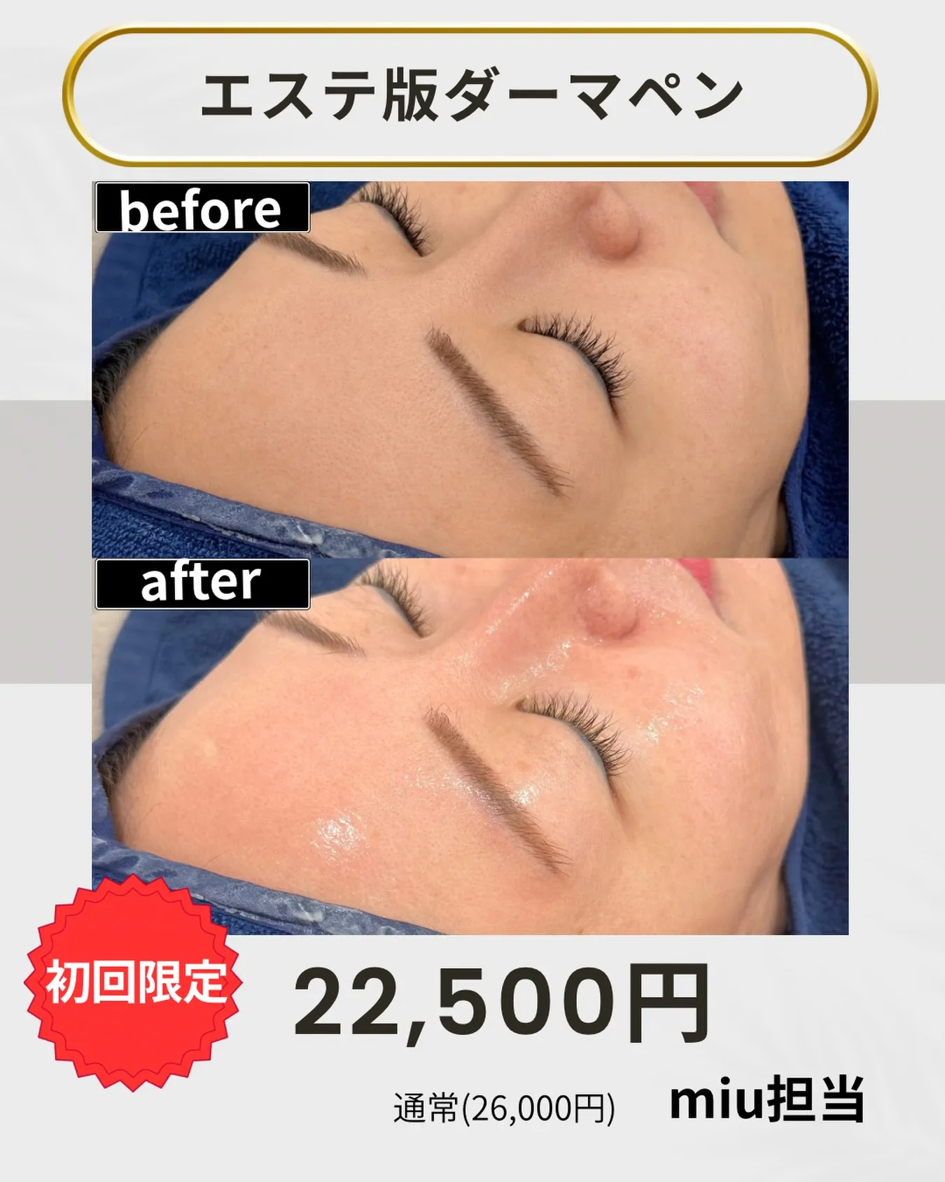 ＼このツヤ、加工じゃありません✨／毛穴・ざらつき・肌のごわつ...