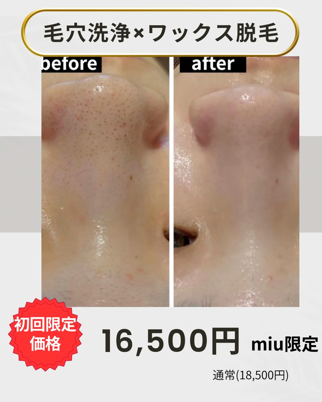 【毛穴洗浄×ワックス脱毛で、つるんと毛穴レス肌へ✨】