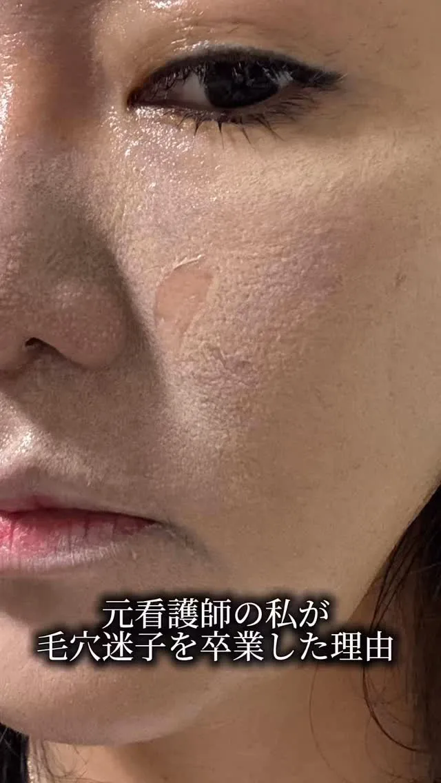 看護師の私が、10年悩み続けた「毛穴」を卒業できた理由