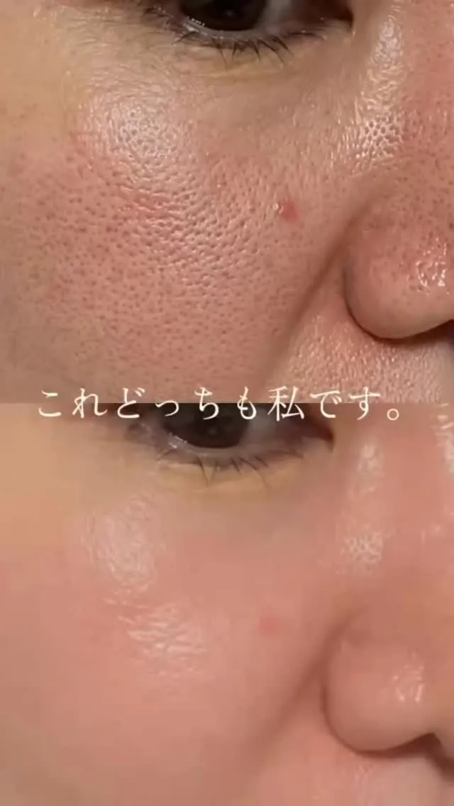 何しても毛穴が目立ってた。